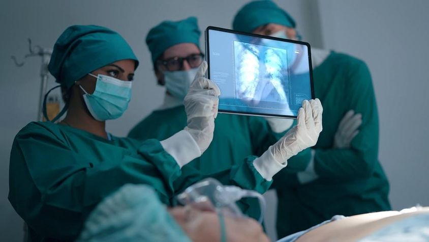 Szakmai orvosi csapat beszélget és megvitatja egy tüdőgyulladásos beteg röntgenfelvételét.